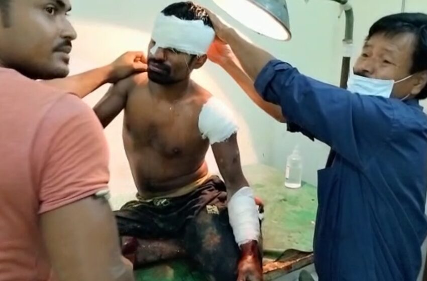 দায়ের কোপে রক্তাক্ত যুবক!!