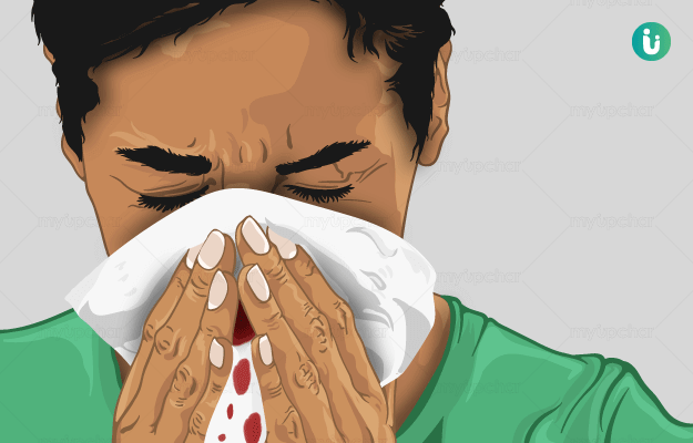  নাক থেকে রক্তক্ষরণ। ডাঃ অরূপ চক্রবর্তী